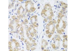 Immunohistochemistry of paraffin-embedded Human stomach using MIP Polyclonal Antibody at dilution of 1:100 (40x lens). (Mip 抗体)