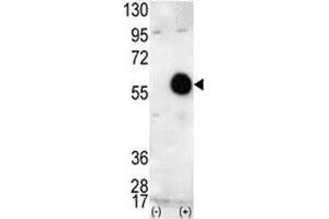 Western blot analysis of AKT2 antibody and 293 cell lysate (2 ug/lane) either nontransfected (Lane 1) or transiently transfected with the human gene (2). (AKT2 抗体  (AA 416-444))