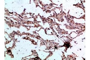 Immunohistochemical analysis of paraffin-embedded human-lung, antibody was diluted at 1:200. (GDF2 抗体  (AA 371-420))