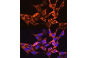 Immunofluorescence analysis of NIH-3T3 cells using F Rabbit mAb (ABIN7267150) at dilution of 1:100 (40x lens). (FABP1 抗体)