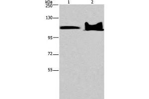 Western Blot analysis of Mouse heart and brain tissue using KDM4C Polyclonal Antibody at dilution of 1:800 (KDM4C 抗体)