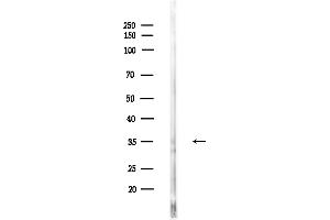 anti-Aldolase B, Fructose-Bisphosphate (ALDOB) (C-Term) antibody