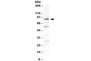 Western blot testing of human duodenum lysate with OSBPL10 antibody at 1ug/ml. (OSBPL10 抗体)