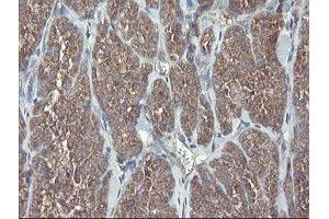 Image no. 11 for anti-Prefoldin Subunit 3 (PFDN3) antibody (ABIN1501702)