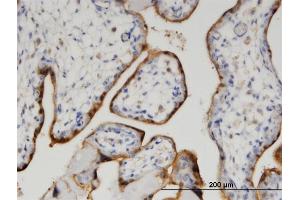 Immunoperoxidase of monoclonal antibody to CLIC5 on formalin-fixed paraffin-embedded human placenta. (CLIC5 抗体  (AA 91-190))