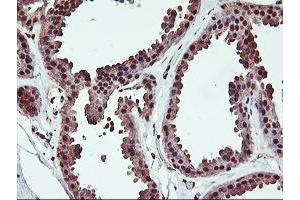 Immunohistochemical staining of paraffin-embedded Human breast tissue using anti-SAMHD1 mouse monoclonal antibody. (SAMHD1 抗体)