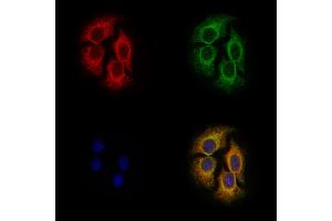 ABIN6258435 and ABIN6275055 staining Hela cells by IF/ICC. (DHRS4 抗体  (C-Term))