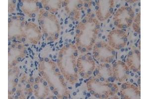 DAB staining on IHC-P; Samples: Mouse Kidney Tissue (PTX3 抗体  (AA 183-381))