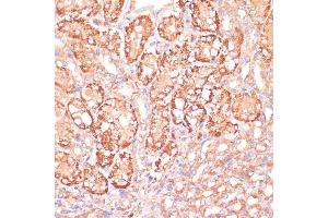 Immunohistochemistry (IHC) image for anti-Mitogen-Activated Protein Kinase Kinase 3 (MAP2K3) (AA 1-170) antibody (ABIN6143484)