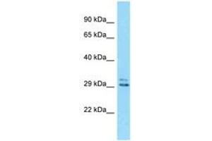 EID2 antibody  (AA 155-204)