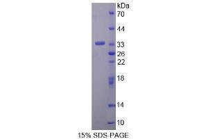 SDS-PAGE analysis of Human ANTXR2 Protein. (ANTXR2 蛋白)