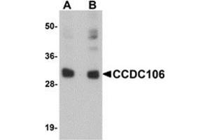 Western blot analysis of CCDC106 in human brain tissue lysate with CCDC106 antibody at (A) 0. (CCDC106 抗体  (C-Term))