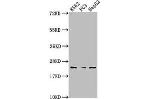 Western Blot Positive WB detected in: K562 whole cell lysate, PC3 whole cell lysate, HepG2 whole cell lysate All lanes: BLVRB antibody at 1:2000 Secondary Goat polyclonal to rabbit IgG at 1/50000 dilution Predicted band size: 23 kDa Observed band size: 23 kDa (BLVRB 抗体  (AA 2-206))