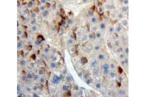 Used in DAB staining on fromalin fixed paraffin-embedded Liver tissue (IREM1 抗体  (AA 45-310))