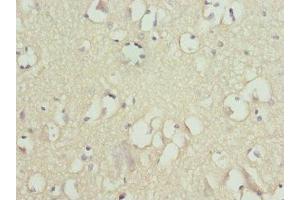 Immunohistochemistry (IHC) image for anti-XYD Domain Containing Ion Transport Regulator 2 (FXYD2) (AA 1-64) antibody (ABIN7170056)