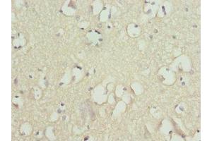 Immunohistochemistry of paraffin-embedded human brain tissue using ABIN7170056 at dilution of 1:100 (FXYD2 抗体  (AA 1-64))