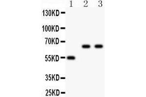 Western Blotting (WB) image for anti-Cytochrome P450, Family 2, Subfamily E, Polypeptide 1 (CYP2E1) (AA 1-310) antibody (ABIN3043821)