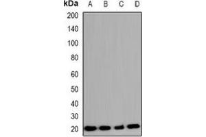 Western blot analysis of COX4-2 expression in A549 (A), K562 (B), mouse lung (C), rat lung (D) whole cell lysates. (COX4I2 抗体)