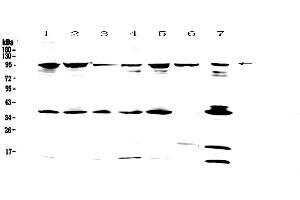 Western blot analysis of FES using anti-FES antibody . (FES 抗体)