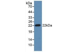 Western blot analysis of recombinant Mouse ADM. (Adrenomedullin 抗体  (AA 24-171))
