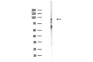 Western blot analysis of lysates from K562 cells(heat-shock,45 min treatment), using Phospho-p95/NBS1 (Ser343) Antibody at 1/1000 dilution.