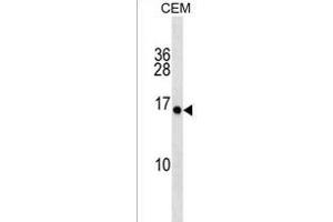 PLGLA Antibody (N-term) (ABIN1539205 and ABIN2850410) western blot analysis in CEM cell line lysates (35 μg/lane). (PLGLA 抗体  (N-Term))