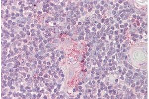 Anti-LYN antibody IHC staining of human thymus. (LYN 抗体  (AA 39-58))