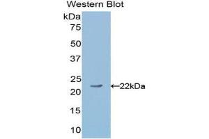Western Blotting (WB) image for anti-Angiopoietin 1 (ANGPT1) (AA 253-429) antibody (ABIN1171922) (Angiopoietin 1 抗体  (AA 253-429))