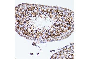 Immunohistochemistry (IHC) image for anti-Voltage-Dependent Anion Channel 2 (VDAC2) (AA 1-100) antibody (ABIN7271337)
