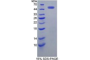 SDS-PAGE of Protein Standard from the Kit  (Highly purified E. (ErbB2/Her2 ELISA 试剂盒)