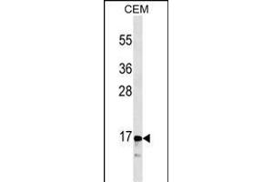 CALCA/CT Antibody (ABIN1536609 and ABIN2843838) western blot analysis in CEM cell line lysates (35 μg/lane). (Calcitonin 抗体  (AA 56-84))