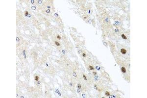 Immunohistochemistry (Paraffin-embedded Sections) (IHC (p)) image for anti-YTH Domain Family, Member 3 (YTHDF3) antibody (ABIN7264421)