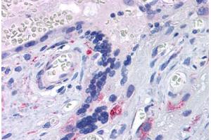 Human Placenta: Formalin-Fixed, Paraffin-Embedded (FFPE) (TLR7 抗体  (AA 900-950))