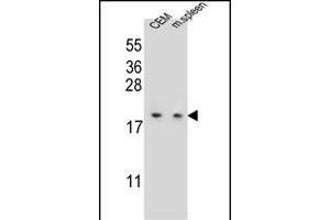 LSM7 Antibody (C-term) (ABIN655625 and ABIN2845104) western blot analysis in CEM cell line and mouse spleen tissue lysates (35 μg/lane). (LSM7 抗体  (C-Term))