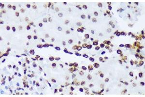 Immunohistochemistry of paraffin-embedded Rat kidney using Phospho-ABL1(Y245) Polyclonal Antibody at dilution of 1:100 (40x lens).