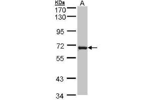 WB Image Sample (30 ug of whole cell lysate) A: MOLT4 , 7. (DENND1B 抗体  (Center))