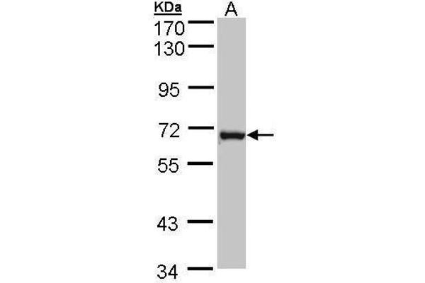 DENND1B 抗体  (Center)