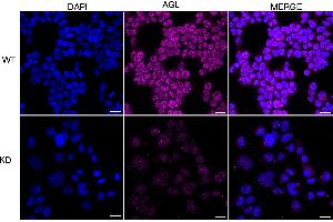 Immunocytochemical staining of HeLa cells using AGL antibody (ABIN7797592), 1:1,000), Top panel: wild-type (WT), Bottom panal: AGL shRNA knockdown (KD). (Recombinant AGL 抗体)