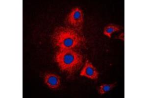 Immunofluorescent analysis of Cytokeratin 19 staining in MCF7 cells. (Cytokeratin 19 抗体  (Center))