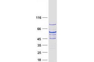 Western Blotting (WB) image for Growth Factor Receptor-Bound Protein 14 (GRB14) protein (Myc-DYKDDDDK Tag) (ABIN2722227)