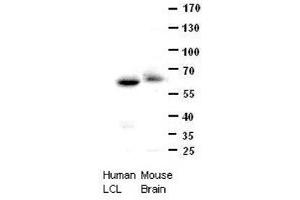 Western Blotting (WB) image for anti-Chaperonin Containing TCP1, Subunit 8 (Theta) (CCT8) (C-Term) antibody (ABIN2782379)