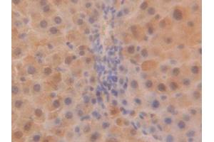 DAB staining on IHC-P; Samples: Rat Liver Tissue (SOD1 抗体  (AA 2-154))