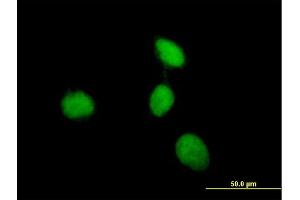 Immunofluorescence of purified MaxPab antibody to MEN1 on HeLa cell. (Menin 抗体  (AA 1-575))