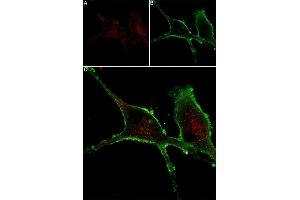 Live cell imaging of mouse NGF 2.