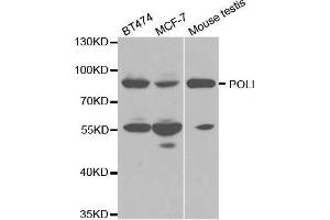 Western blot analysis of extracts of various cell lines, using POLI antibody. (POLI 抗体  (AA 50-350))