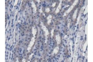 Immunohistochemistry (IHC) image for anti-Sterol Regulatory Element Binding Transcription Factor 1 (SREBF1) (AA 158-390) antibody (ABIN7444382)