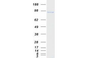 Western Blotting (WB) image for Minichromosome Maintenance Complex Component 6 (MCM6) protein (Myc-DYKDDDDK Tag) (ABIN2725635)