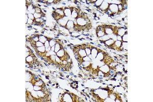 Immunohistochemistry of paraffin-embedded human colon using p70 S6 Kinase 2 Rabbit mAb (ABIN7270034) at dilution of 1:100 (40x lens). (RPS6KB2 抗体)