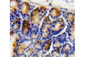 Used in DAB staining on fromalin fixed paraffin-embedded Bowels tissue (ATF4 抗体  (AA 126-291))