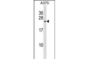 Western Blotting (WB) image for anti-Polymerase (RNA) II (DNA Directed) Polypeptide G (POLR2G) (AA 125-154), (C-Term) antibody (ABIN1881671)